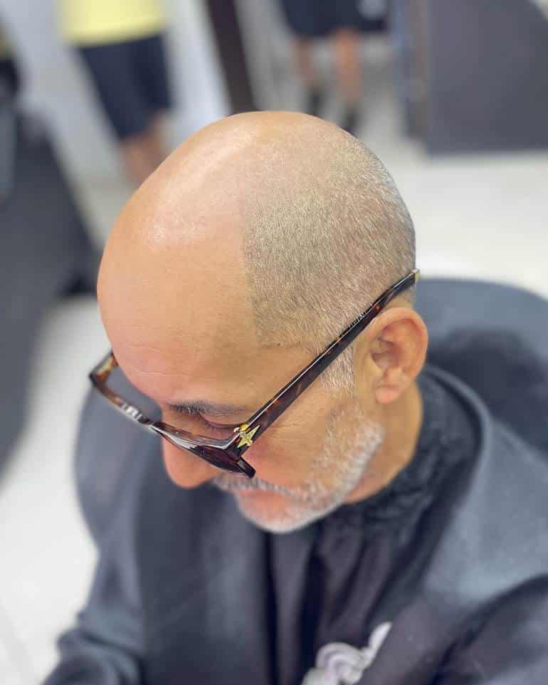 homem careca estiloso