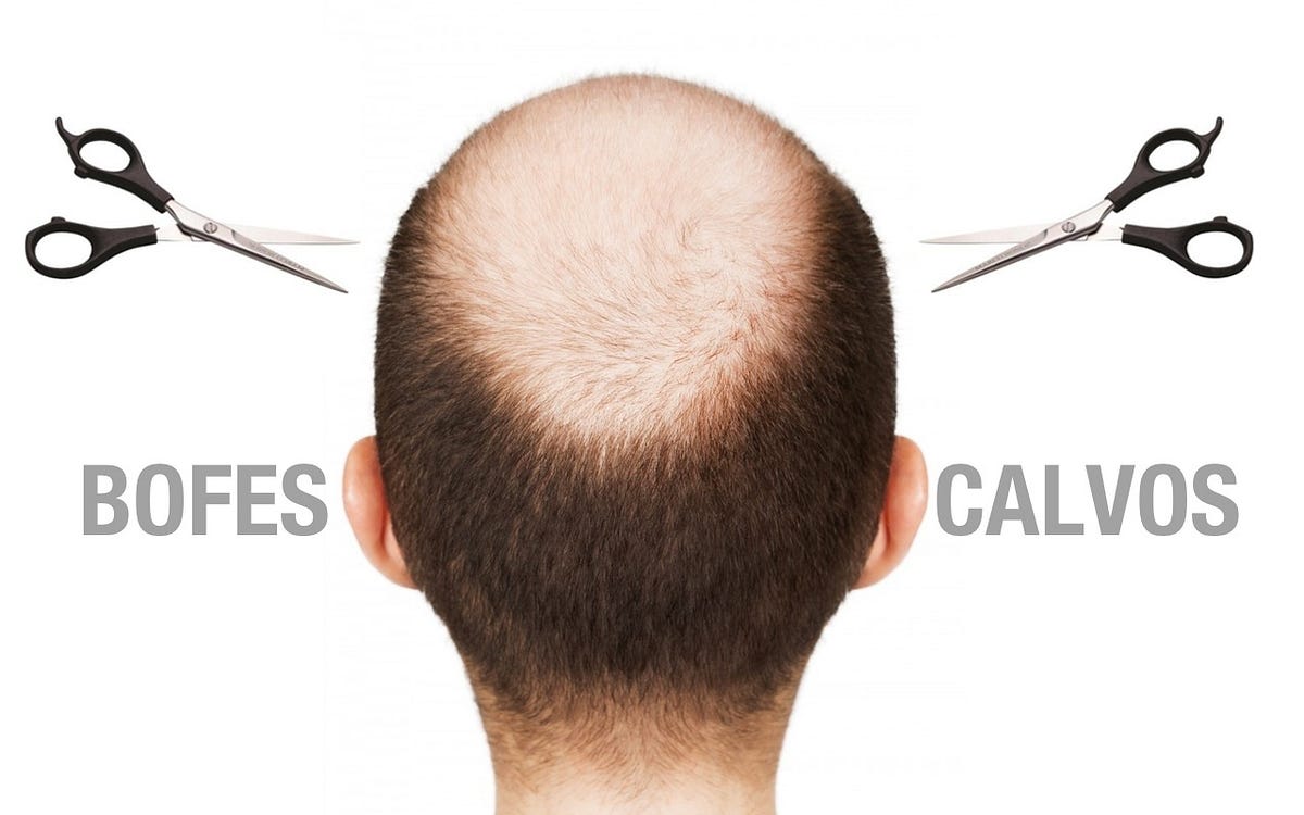 risco em v cabelo masculino
