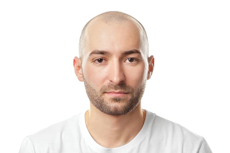 barba ideal para carecas