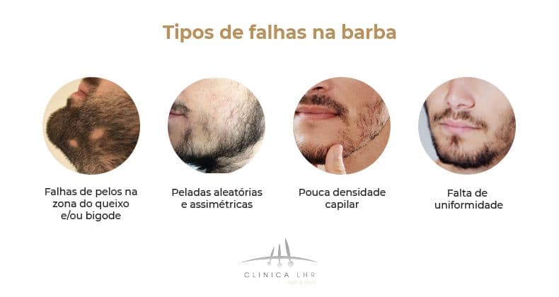 cuidados barba falhada homem