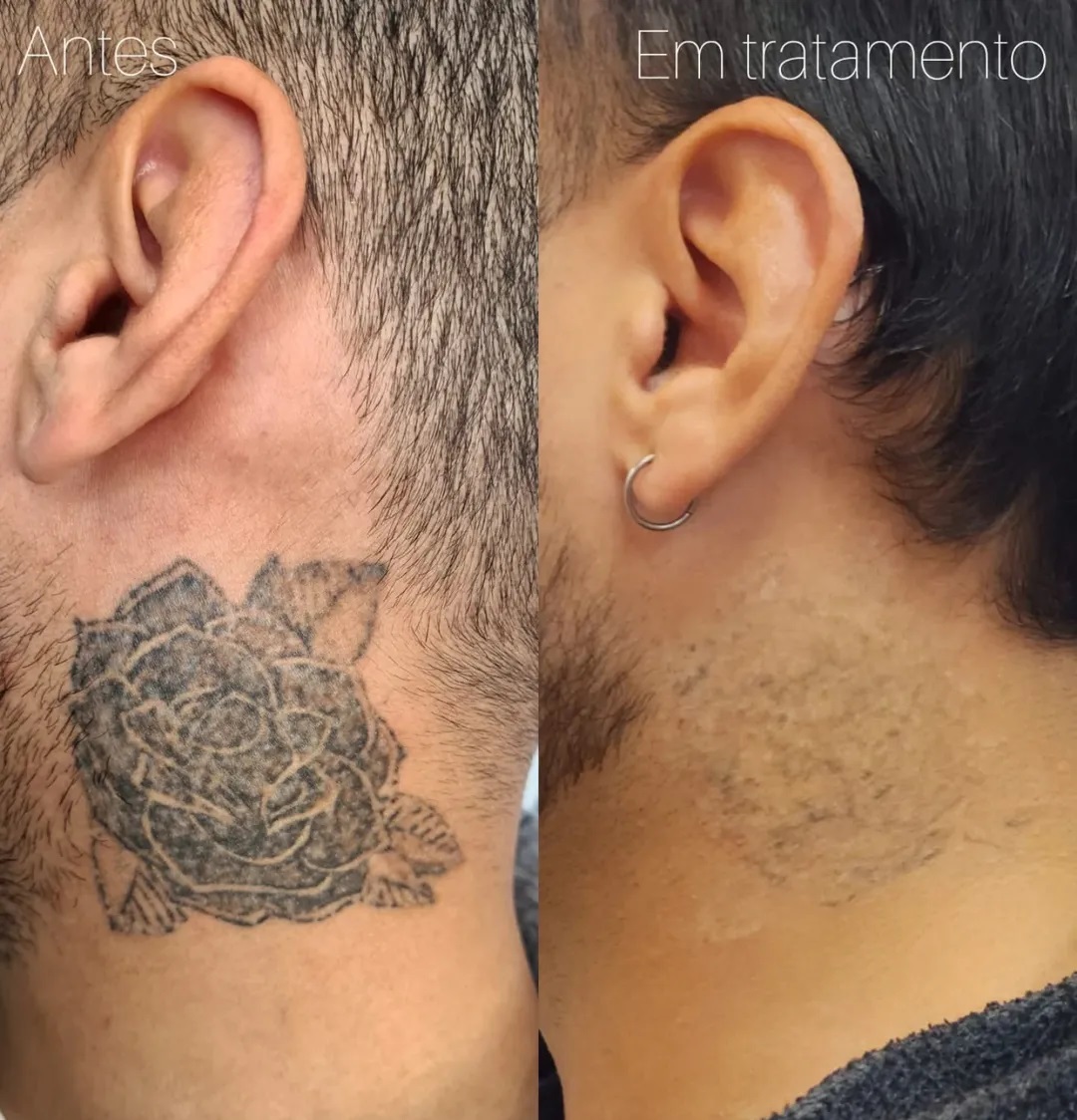 tatuagem pescoço atrás da orelha